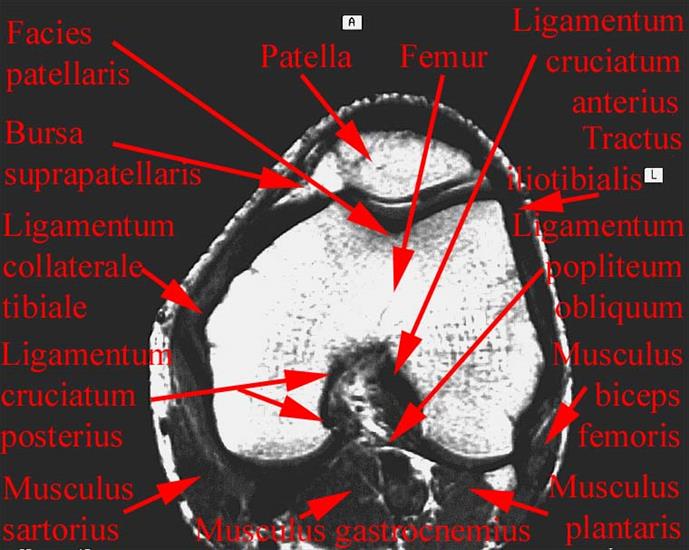 anatomia radiologiczna - 101.jpg